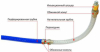  injecto-pipe  ( )